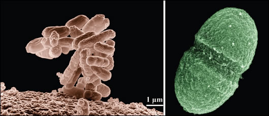 Both E.Coli (left) and Enterococci bacteria (right) are common contaminants in private group water schemes